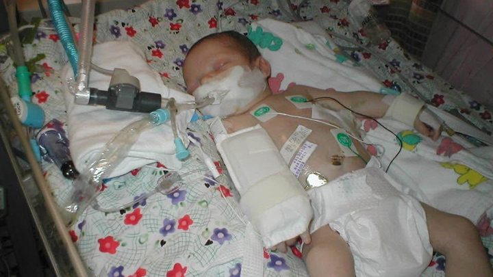 Support Mac's Recovery After Aortic Surgery campaign photo, 1 of 7