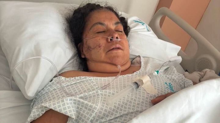 Help Lorena (of El Jordan) recover and cover hospital bills campaign photo, 1 of 5
