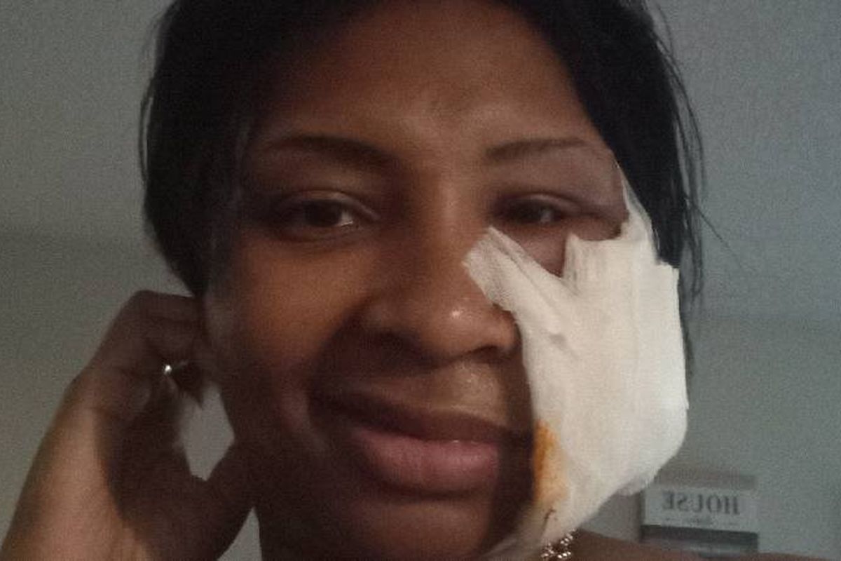 Fundraiser by Ebony Mixon : The bullet that was supposed to take my life