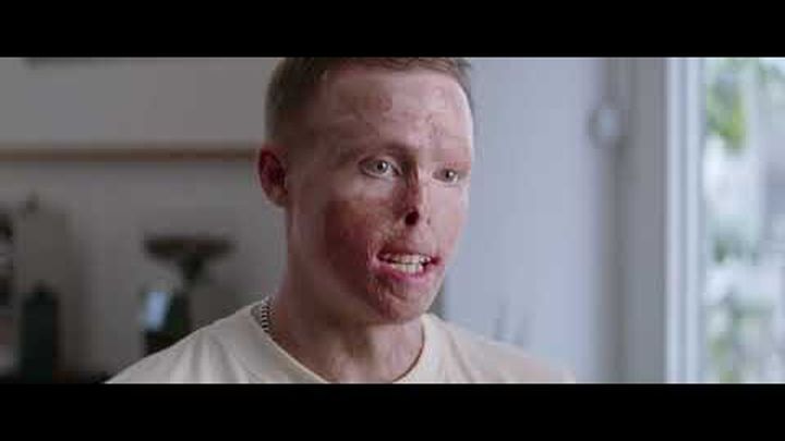 Help me found essential adaptations and surgeries video thumbnail, 1 of 8