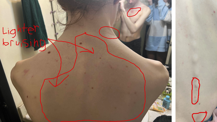 Foto principal de la recaudación de fondos