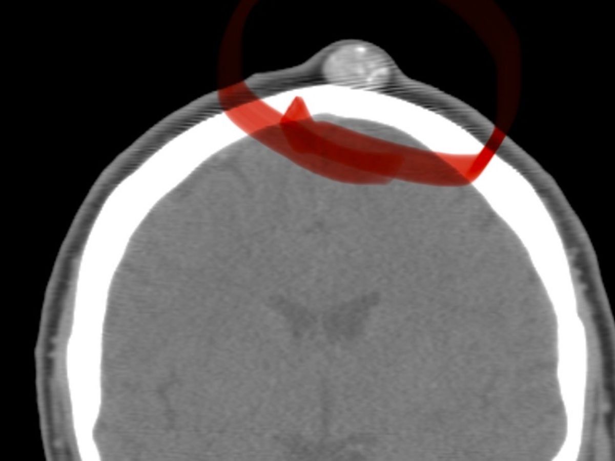 Fundraiser’s main image