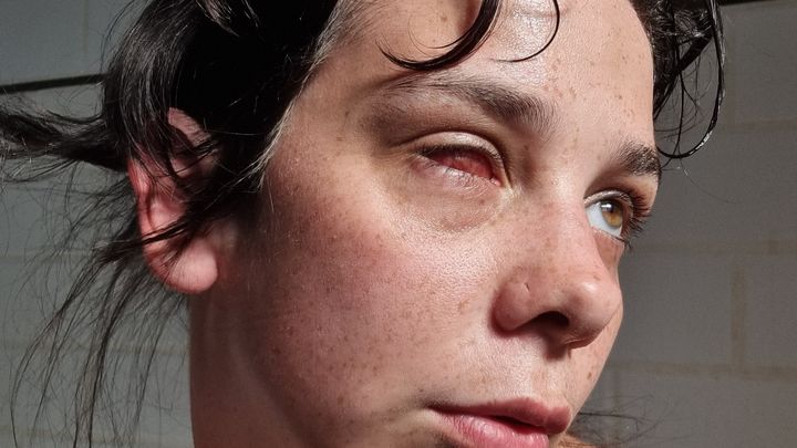 BUY ME PROSTHETIC EYES! campaign photo, 1 of 7