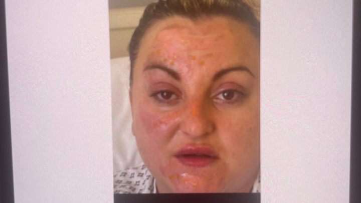 fundraiser-by-charlotte-reynolds-costs-to-help-her-children-have-a