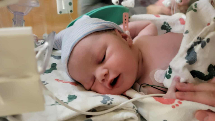 Support Jovie's Heart Surgery Journey campaign photo, 1 of 5