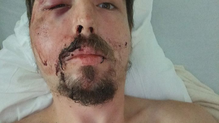 Support Joshua's Critical Recovery Needs campaign photo, 1 of 3