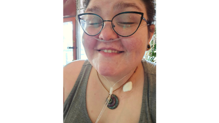 Support Amanda's CTEPH Relief campaign photo, 1 of 2