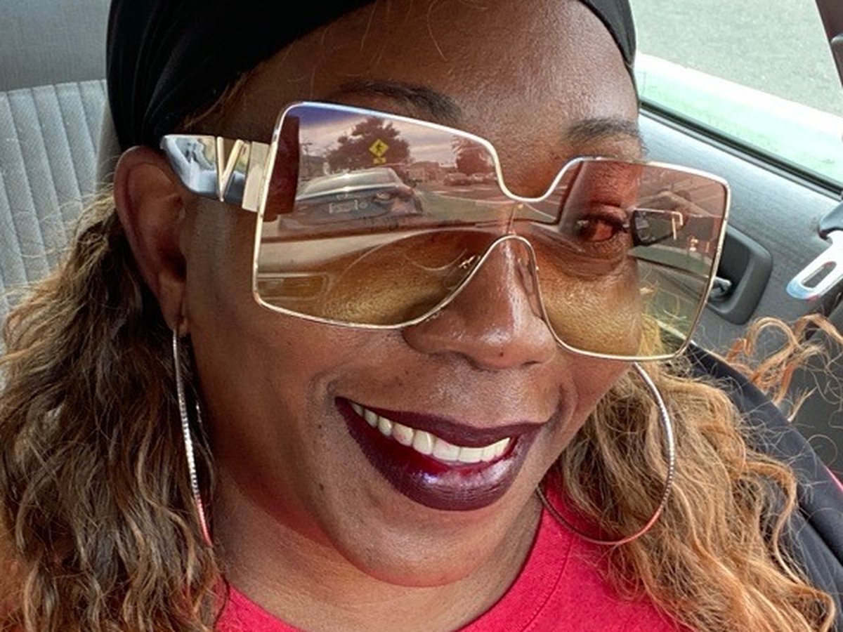 Kim Sims Fundraiser by Kim Sims : Help KIMMY2xs Dance and Live Pain-Free