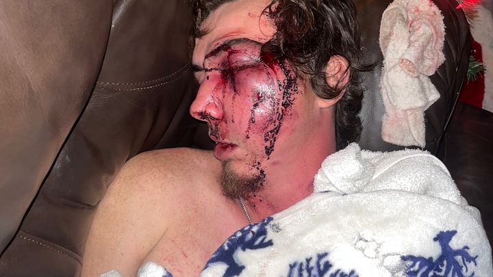 Support Dustin's Brother's Recovery Journey campaign photo, 1 of 3