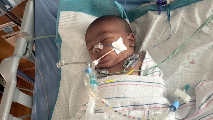 Support Baby Carter’s Recovery campaign photo, 1 of 11