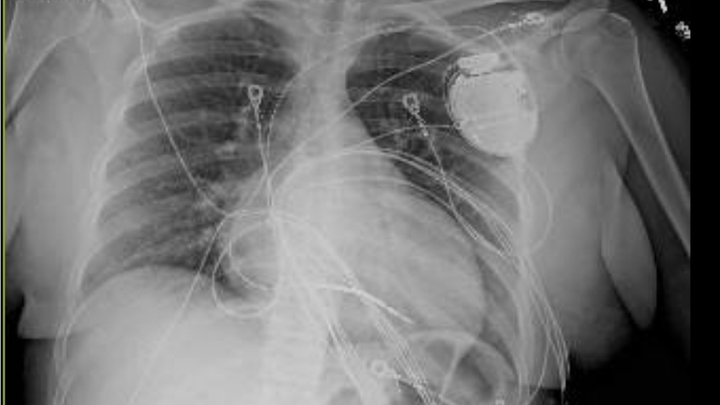 Help Jessica Rebuild After Heart Failure campaign photo, 1 of 3