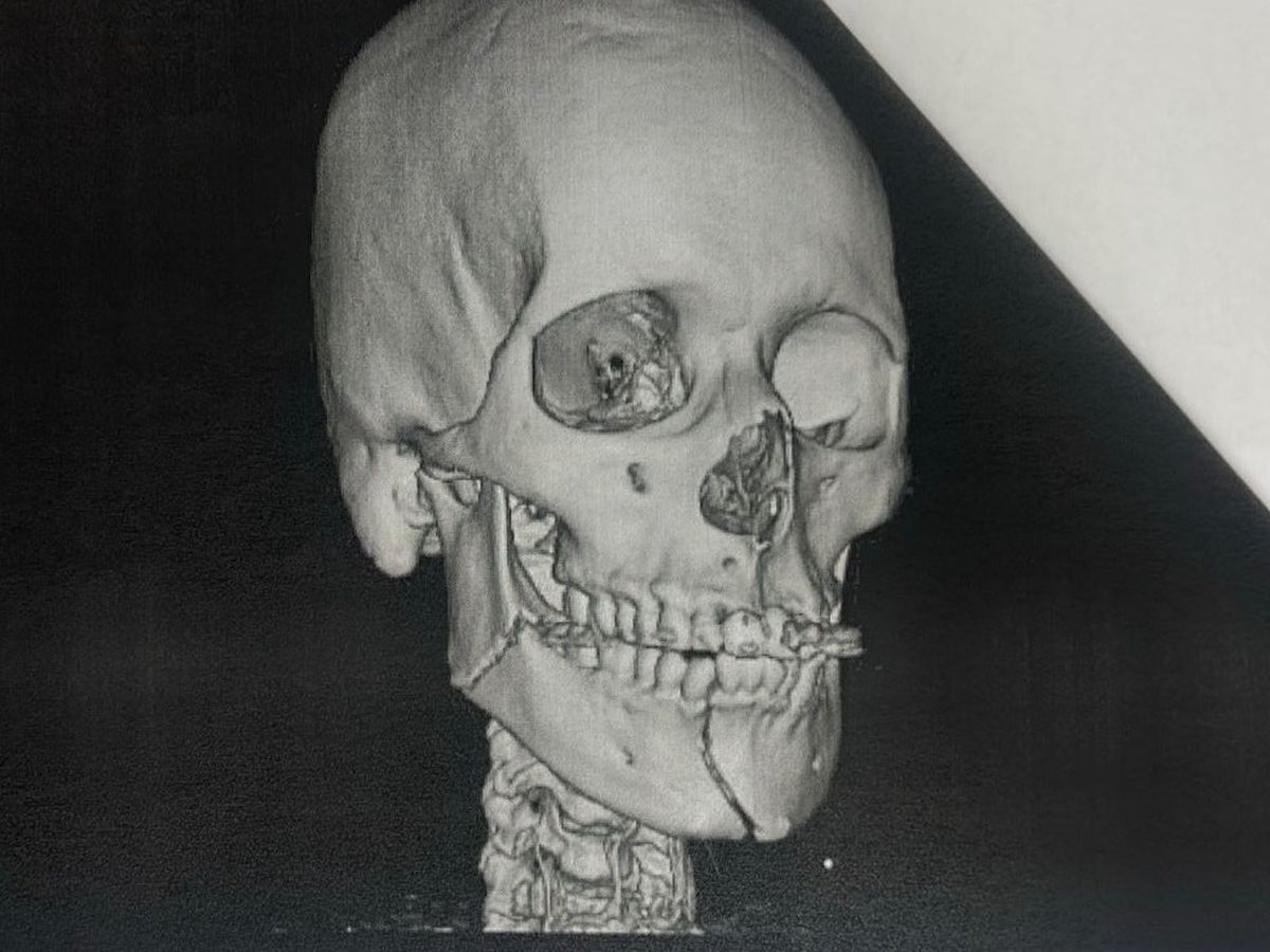 Fundraiser’s main image