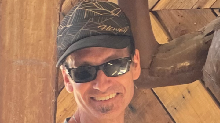Help My Brother Rebuild His Life After Tragic Amputation campaign photo, 1 of 6