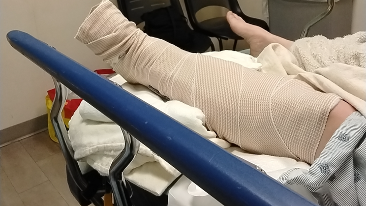Fundraiser by Phyllis Huffman : Support Robin Young After Her Ankle Surgery