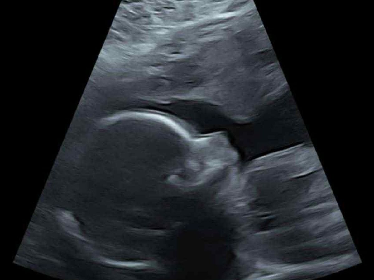 Fundraiser’s main image