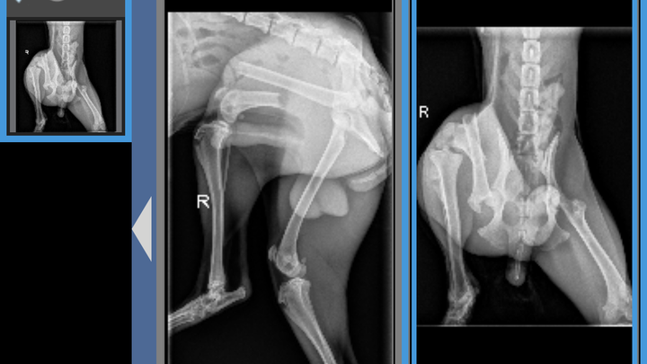Theos broken femur surgery campaign photo, 1 of 6