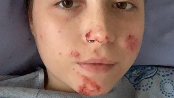 Emergency Recovery fund for Willow Huycke campaign photo, 1 of 3
