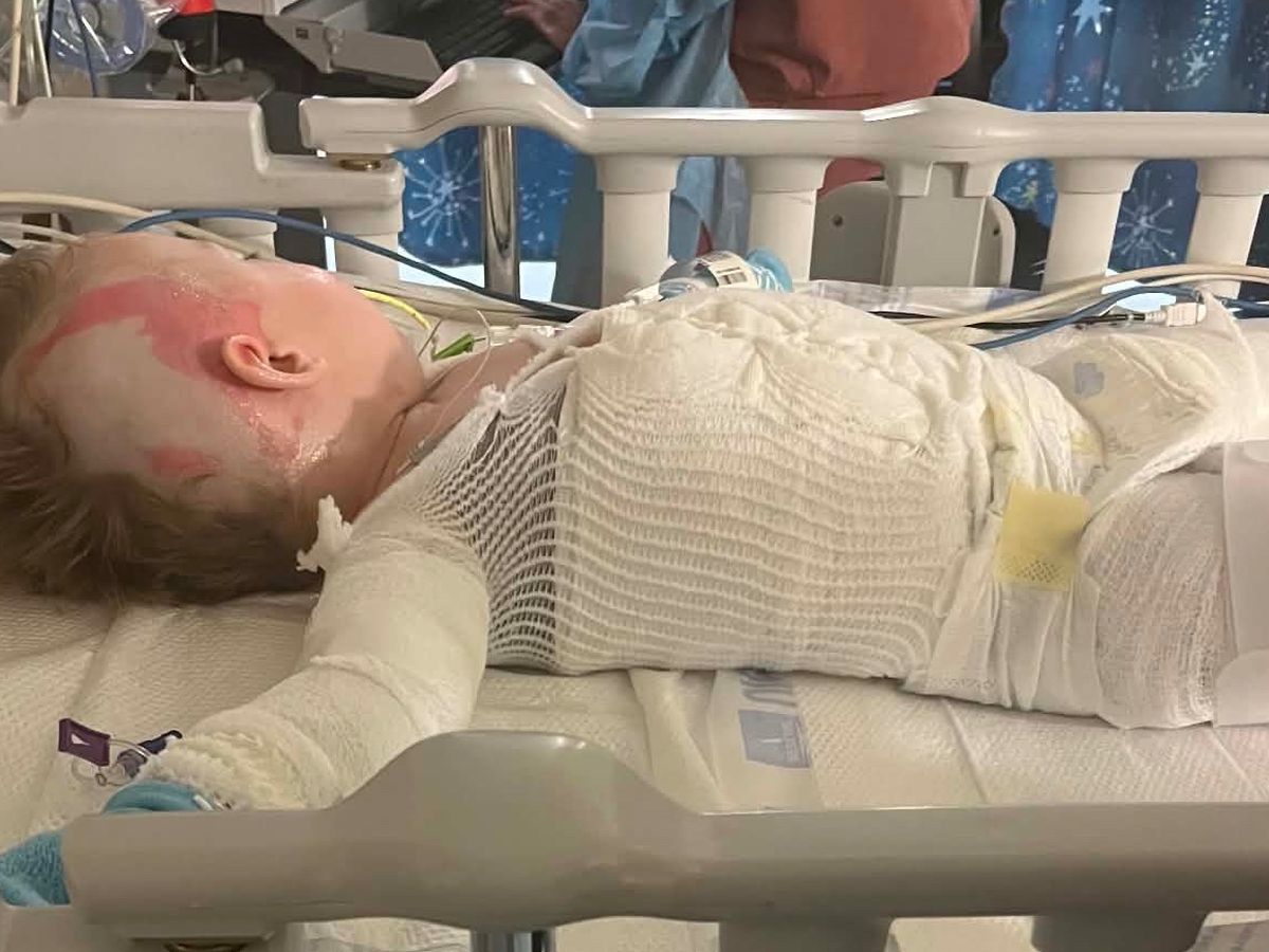 Help My Nephew Recover from Severe Burns campaign photo, 1 of 3