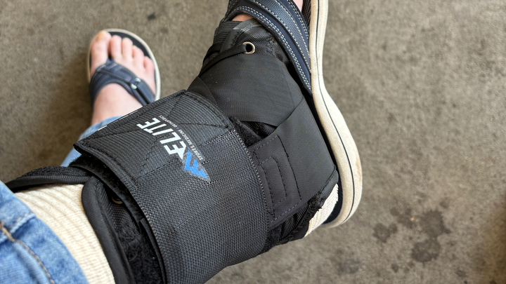 Melanie needs ankle surgery! campaign photo, 1 of 2