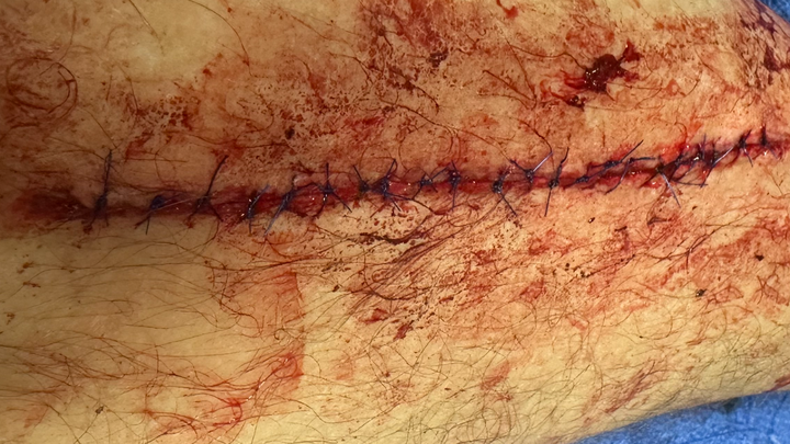 Run Over by a Jeep need help ! campaign photo, 1 of 3