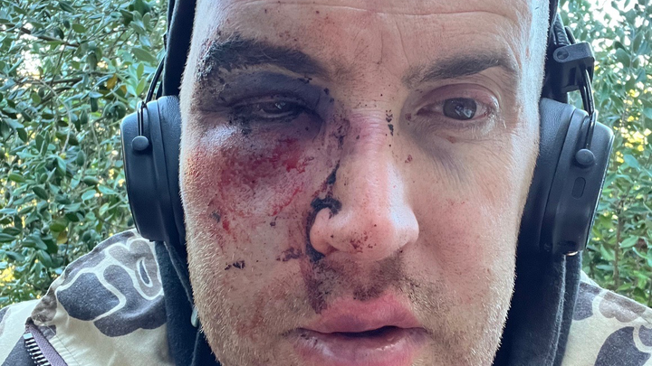 Fundraiser by Jake Luce : Support Jake's Recovery and Dental Care