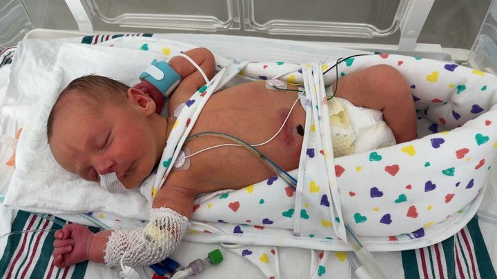 Support Baby Colton's NICU Journey campaign photo, 1 of 4