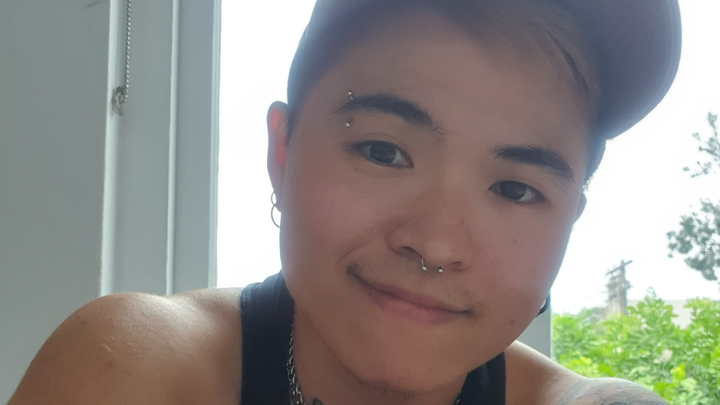 Help Rax Finally Get His Top Surgery campaign photo, 1 of 3