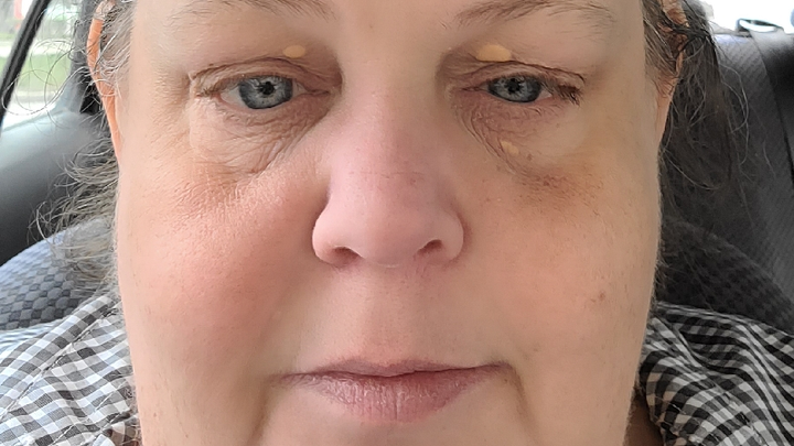 Help Maryella Heal and Find a New Feathered Friend campaign photo, 1 of 8