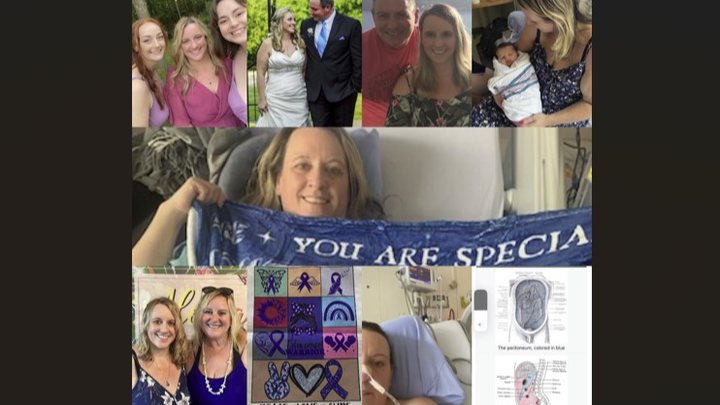 My sister Heather's Rare Stage 4 Pareneal Colorectal Cancer campaign photo, 1 of 3