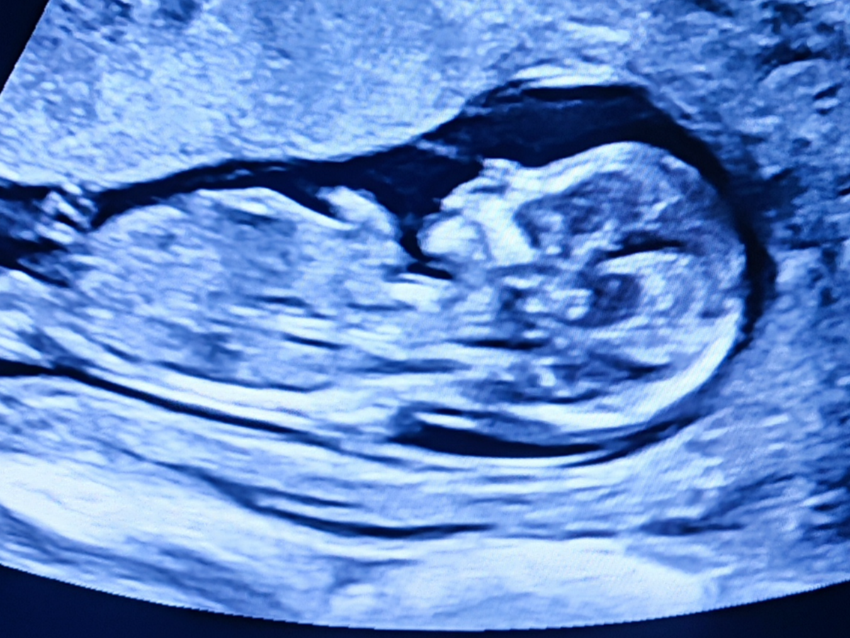 Fundraiser’s main image