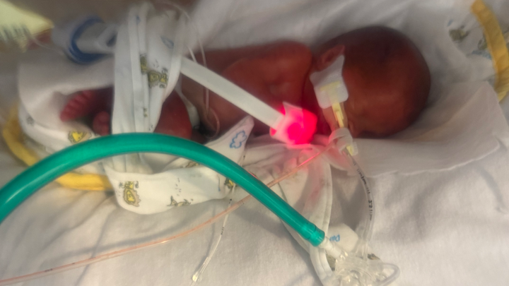 Care for the Wilson Family and Their Preemies campaign photo, 1 of 4