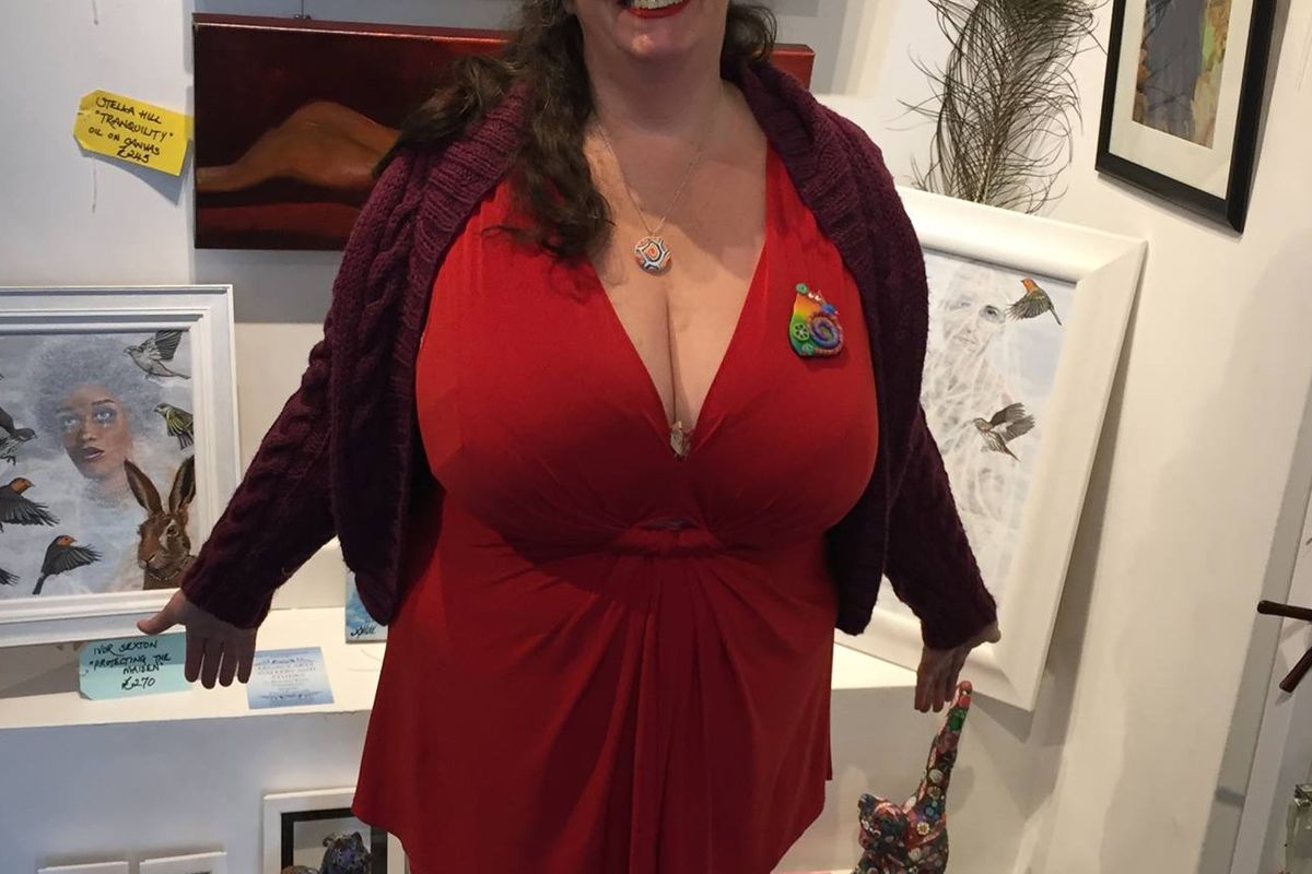 Scot with 32K boobs gets death threats over appeal to fund breast reduction