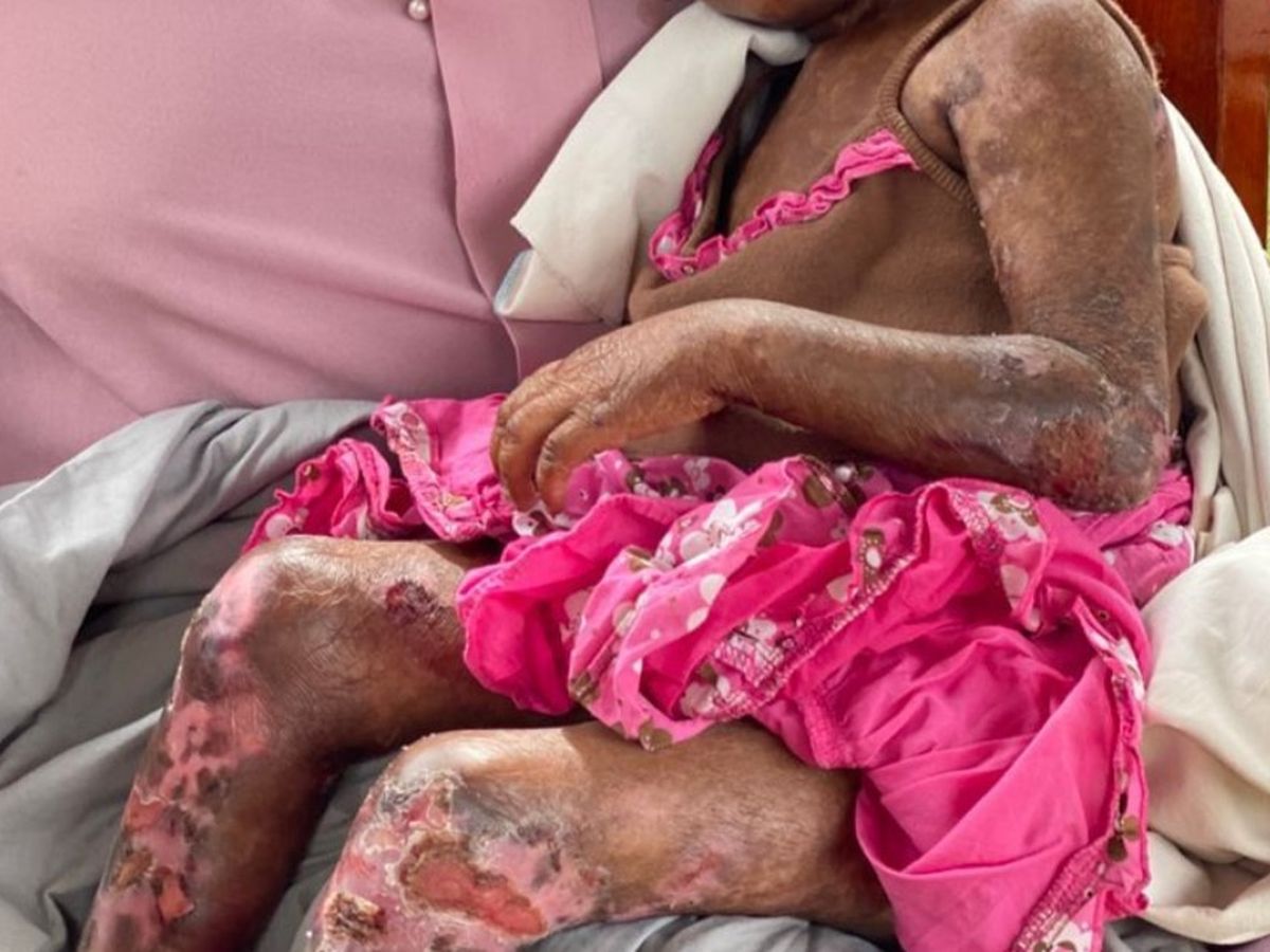 A Life of Pain-Let’s Give Lauza a Chance at Some Comfort campaign photo, 1 of 8