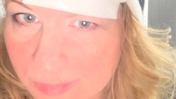 Help Stacee in her fight against Melanoma campaign photo, 1 of 2