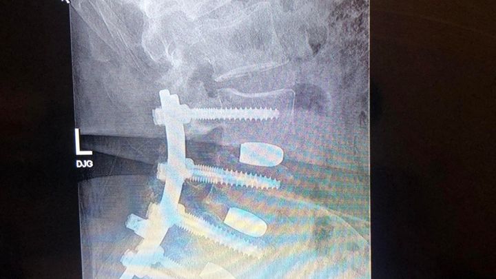 Help Bob's Back Heal! campaign photo, 1 of 2