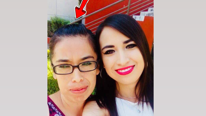 Tratamiento de karla fue diagnosticada cancer de mama etapa4 campaign photo, 1 of 3