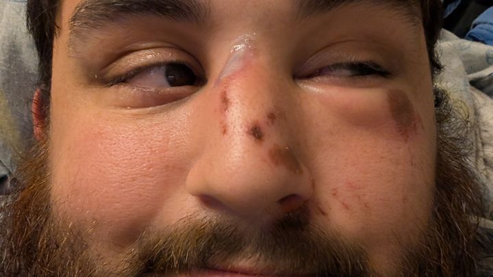Fundraiser by Joshua Jimenez : Support for Surgery and Recovery After ...