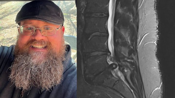 Help Tom Recover After Back Surgery campaign photo, 1 of 5