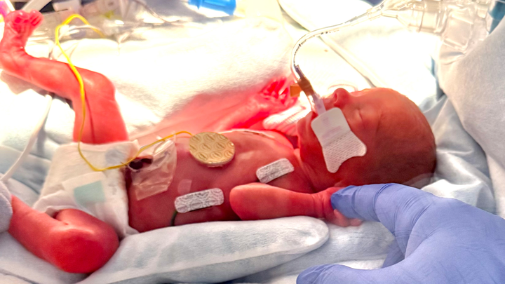 Support Baby Rowyn’s NICU Journey campaign photo, 1 of 6