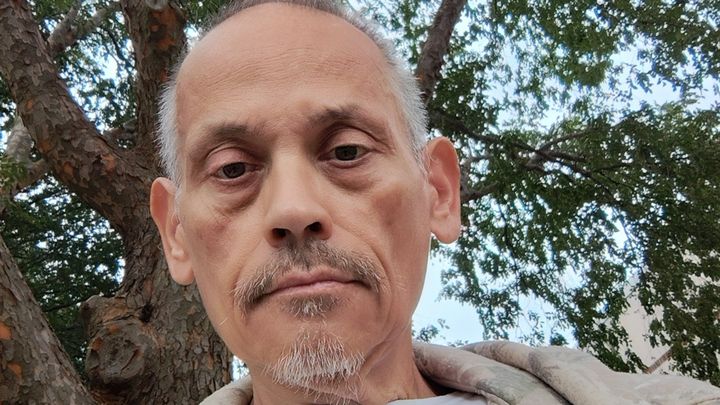 Help Tim Heal After Eye Surgery campaign photo, 1 of 8