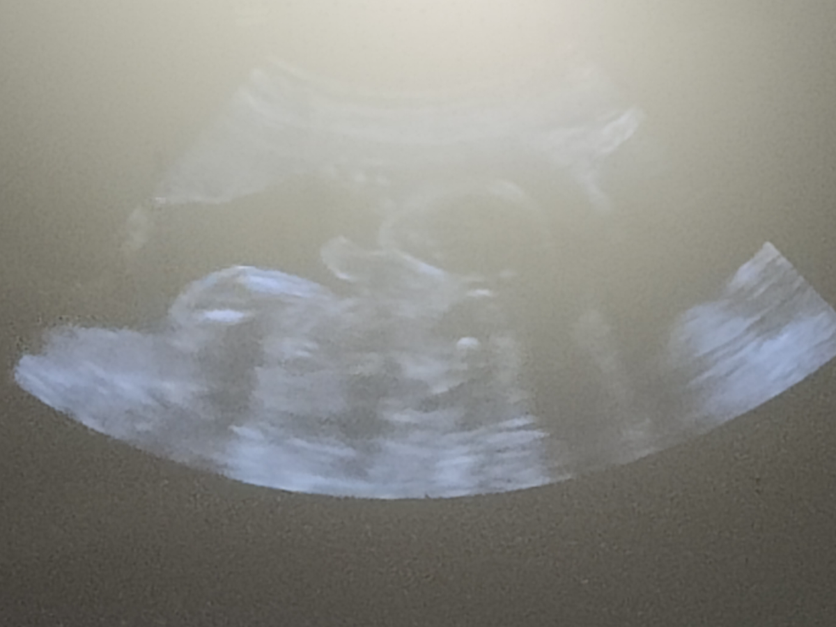 Join Us in Celebrating Our Baby's True Self campaign photo, 1 of 3