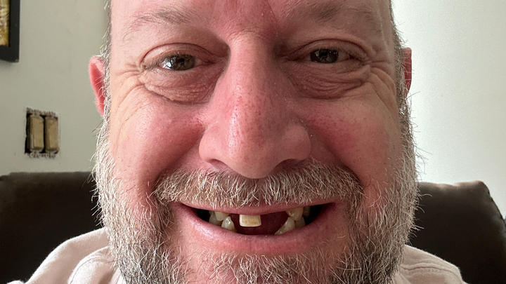 Restoring My Smile After Addiction Recovery campaign photo, 1 of 4