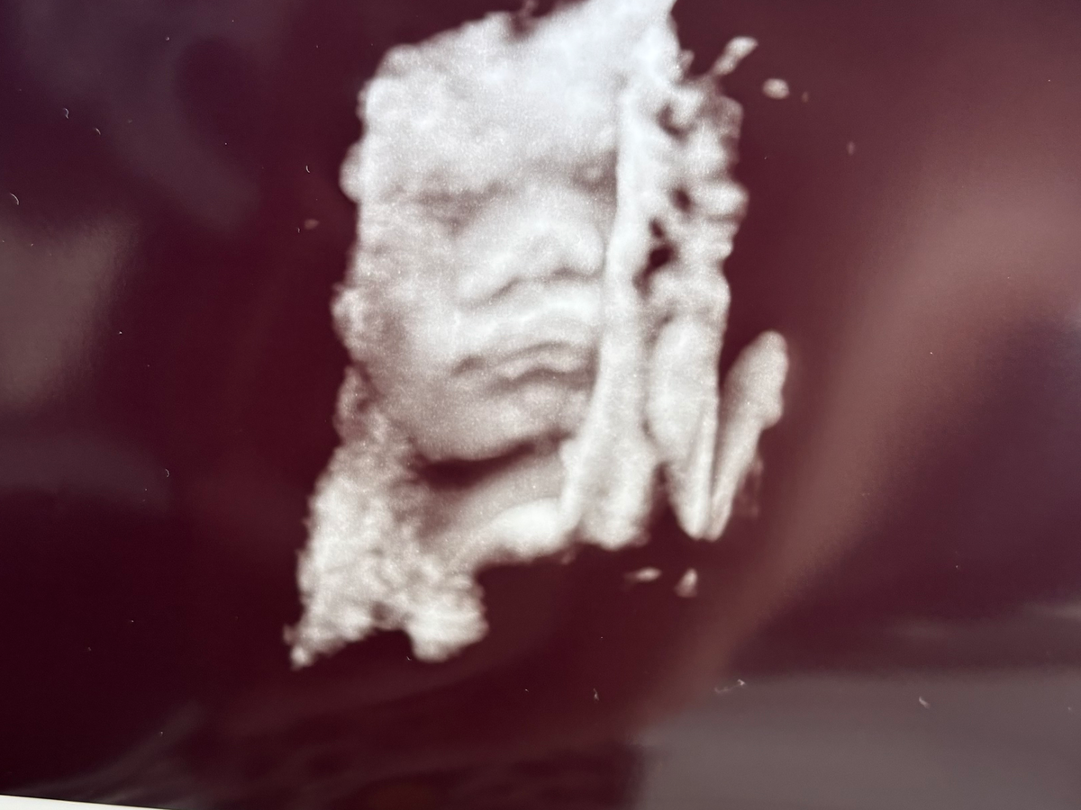 Fundraiser’s main image