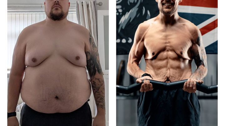 Donate to my loose skin surgery campaign photo, 1 of 5