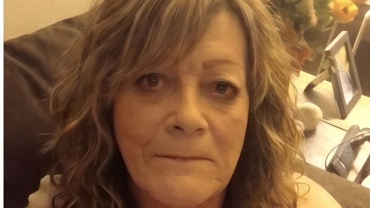 Help Me Restore My Smile and Confidence campaign photo, 1 of 8