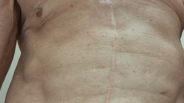 Main fundraiser photo