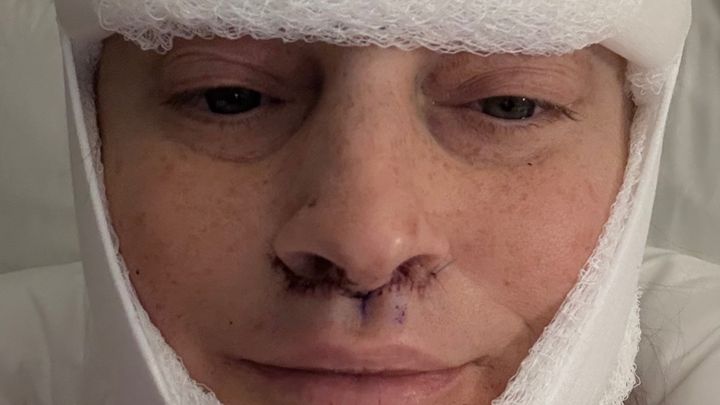 Support Josie: Gender-Affirming Surgery & Recovery campaign photo, 1 of 13