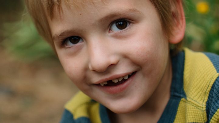 Life changing surgery for George! campaign photo, 1 of 2