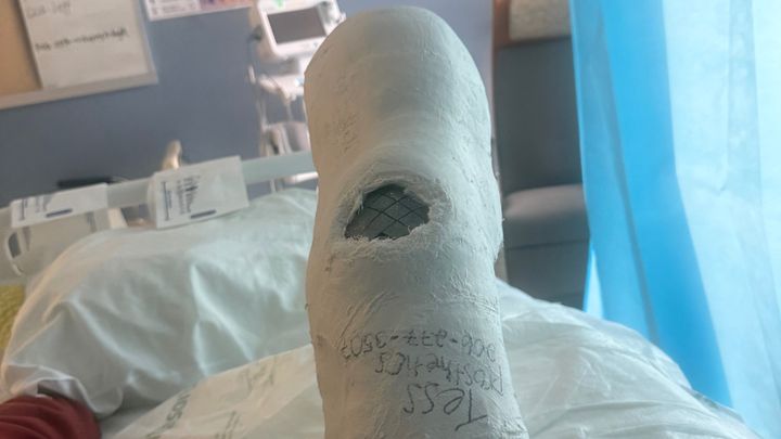 Support Brian’s Recovery After Amputation campaign photo, 1 of 4