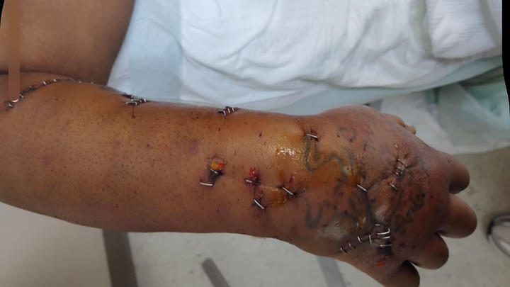 Help Mariah Campbell Recover from Dog Attack campaign photo, 1 of 7